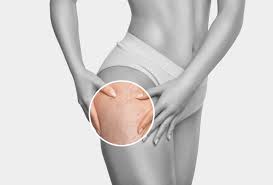 Stretch Mark Aromatherapy Support - 200ml